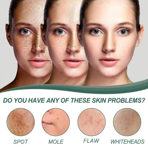 Herbal Natural Blemishes Hydrating Cream - Image 4