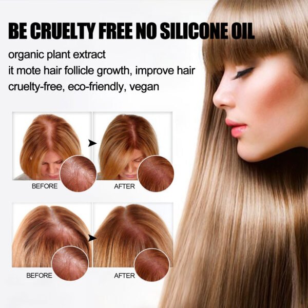 Ginger Soap, Anti-Loss Hair - Image 5