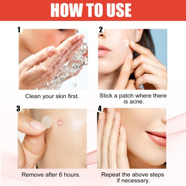 Hydrocolloid Acne Patch Face Invisible Makeup - Image 7