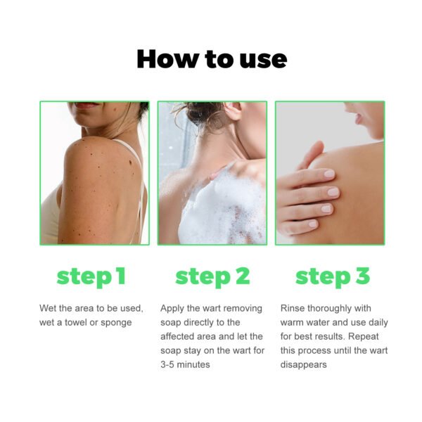 Skin Tag Removal Rubber Band - Image 7